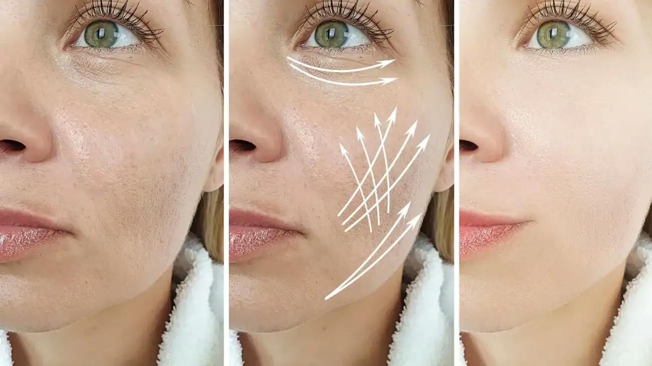 Can One Treatment Really Tackle More Than One Skin Concern Stony Stratford?