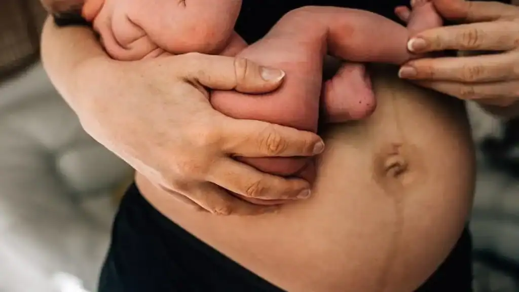 Why Is My Stomach Still Big After Pregnancy Stony Stratford?